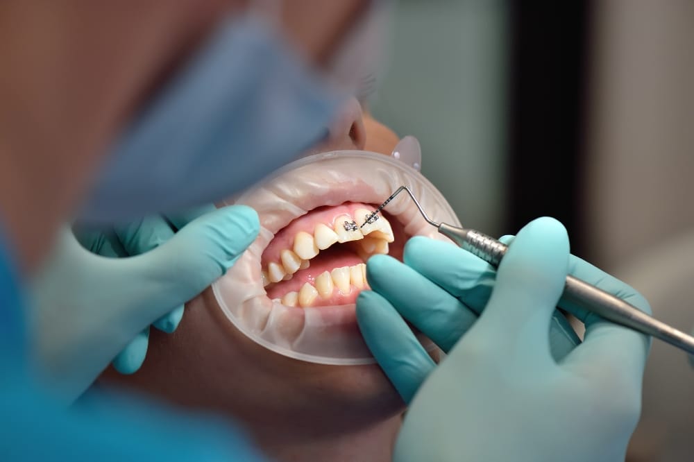 emergency dentist in Pflugerville